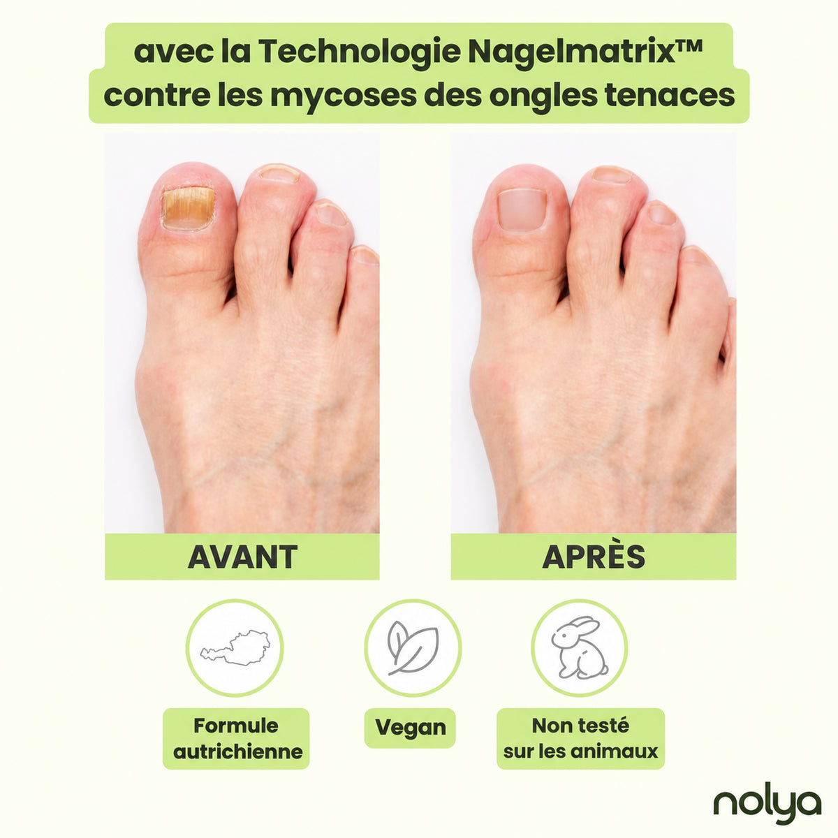 Nolya stylo soin ongles
