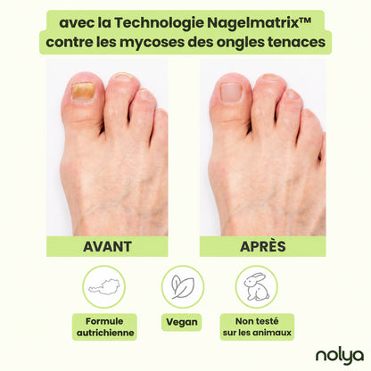 Nolya stylo soin ongles